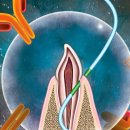 J Dental Lab 이미지