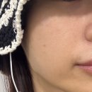 (주)미주 | 라디쥬 스킨부스터를 소개합니다 (+미주란 후기)