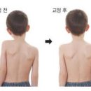 185CM키우리성장클리닉 네이버블로그