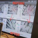 케어존 | [뷰티] 부산 두피관리 &#34;탈모케어존 동래점&#34; 후기: 두피 스케일링으로 각질도 제거하고 열감도 내리고 ☺️