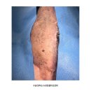 태성동물병원 | 오산 동물병원 강아지 CT 촬영과 유선종양 제거 수술 후기 치료케이스