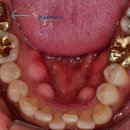 내이치과기공소 이미지