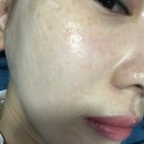 성서 스킨플래닝 가격 뷰티지아 이곡동 피부관리 추천