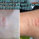 준성형외과 이미지
