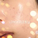LDM+피코토닝 피부과 관리받고[적립금] 백억커피 100원 커피[쿠폰] 마시고 로또산 날