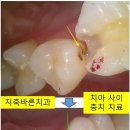 원 치과기공소 이미지
