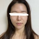 아지트케이 플래그쉽 스토어 의정부 | 아트먼트 모네 모케팅 너무 어렵다 시술 후기