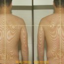 청림한의원 | 족저근막염 치료후기(청림한의원)