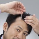 일산하이모가격 부분밀란가발 모웰가발 박승철위그스투디오를 거쳐서 플러스모발에 상담오신 이야기/후기