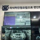 사랑니발치,임플란트 수면치료 후기