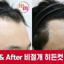 헤어라인 - 고양시 일산동구 | 헤어라인