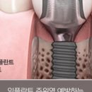 편안미치과의원 네이버블로그