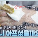 무좀균 심한 발톱 관리.gif 이미지