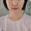 증평마취통증과의원 | 통증없는 울쎄라 쿨소닉 이중턱 심부볼 후기 청담 큐비큐의원