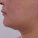 청담청초성형외과의원 이미지