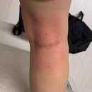 하안365별약국 | 임신 소양증 기록 (1) : 임신 초기 소양증, 13~23주 상태, 내돈내산 제품 후기