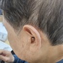오티콘 보청기 | 김제보청기. 오티콘 오운 CIC 보청기 사용후기 (70대 남성 고객님 사례)