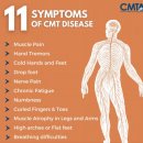 샤르코 마리 투스병(Charcot-Marie-Tooth disease, CMT) 이미지