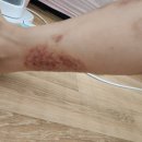 최성진내과의원 이미지