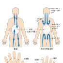 음식먹고 체했을때 민간요법 이미지