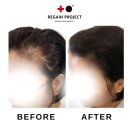 리게인프로젝트 일산 이미지