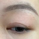 (주)대안의료기 | [공지] 쌍꺼풀 테이프 vs 수술 vs 옵티폴드 — 3가지 방법 솔직하게 다 비교해봤어요