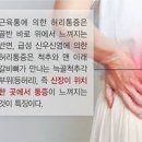 온몸근육통 발생 원인 전신 골반근육통 몸살 증상 이미지