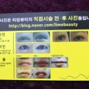 라임피부관리