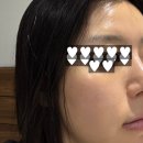 경희한의원 | 금호동 경희최우수한의원 스킨 부스터 2회차 후기