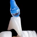 일정치과기공소 이미지