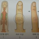 손가락을 운동시켜라 이미지