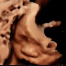 차병원 옆 | 강남차병원 입체초음파 후기 - 28주 아기 몸무게, 역아 돌리기, 태동 느낌