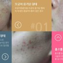 윤앤송한의원 네이버블로그
