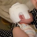 아이사랑두헬멧 대전센터 | 아기두상헬멧 매우 솔직한 일주일 적응 후기(+아이사랑두 추천인)