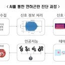 뇌졸중 후 연하장애 &#39;이것&#39; 하나로 진단 이미지