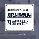 ＜김포신경외과＞ 발뒤꿈치 초기 증상 파악으로 이미지