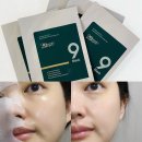 수분마스크팩 닥터트웬티프로젝트 나인 마스크 진정 케어 후기
