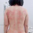 파주운정 바디&amp;피부관리, 뷰티달링 맞춤관리로 다시 태어났어요!