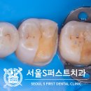 퍼스트치과기공소 이미지