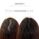 채도스칼프 | 탈모치료는 두피문신으로 강남 갓스칼프에서해결하세요