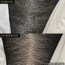 소즈스튜디오 | 마곡두피문신 SMP 부작용, 솔직히 말하면 망한 후기 1분만 읽어보세요