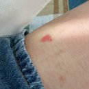 이노플러스성형외과의원 이미지