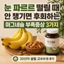 밤마다 깬 진짜 이유! 마그네슘 부족증상 극복 찐 후기 : 눈밑떨림, 다리에 쥐