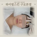 구로-구로-구로-1080 | [구로피부관리] 여드름흉터전문 하이필스킨 구로본점 : 장벽복구 프로그램 받은 후기