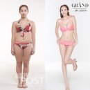 허쉬성형외과의원 | [세태진단] 성형조장 무분별 성형광고...도 넘은 상술 ‘빨간불’