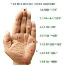 수지침 이미지