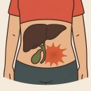 석성중앙가스 | 윗배 통증, 만성 담낭염 위험 신호