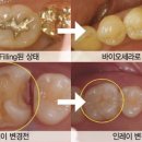 바이오치과 기공소 이미지