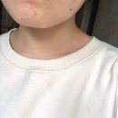 나비에스한의원 | [Review] 나비에스 피부과 점제거 후기(내돈내산)