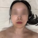 코오롱글로벌(주) 의정부센터 | 다산 피부과 에스테틱 추천 치유 뷰티 센터 알테온 리프팅 솔직 후기